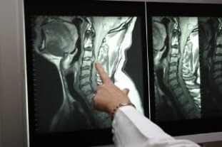 Radiografia del collo