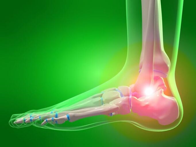 Infiammazione della caviglia con artrosi