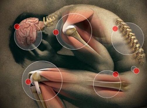 Cosa causa dolore alle articolazioni