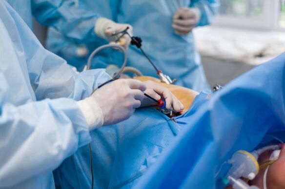 Nella fase avanzata dell'osteocondrosi della colonna lombare è necessario un intervento chirurgico