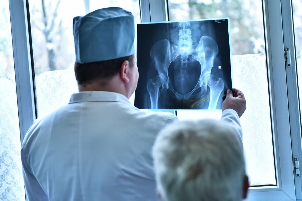 Il medico esamina l'immagine di un'articolazione dell'anca con osteoartrosi